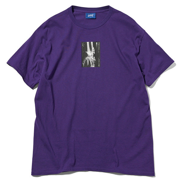 X-Ray Tee