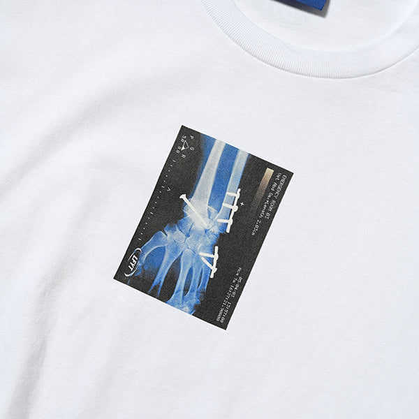 X-Ray Tee