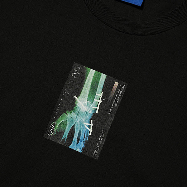X-Ray Tee