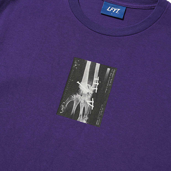 X-Ray Tee